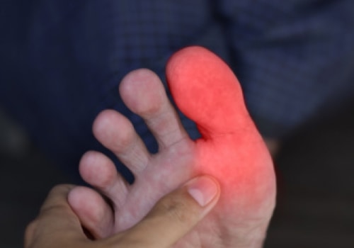 Understanding Unexplained Big Toe Pain: Causes and Solutions